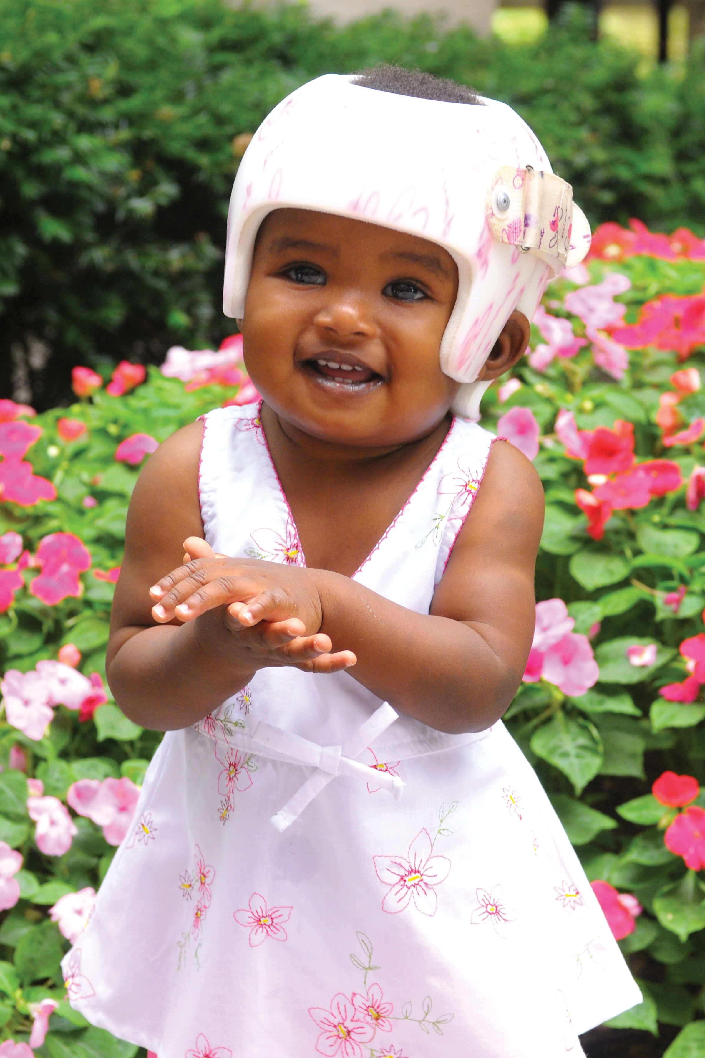 When to Use a Plagiocephaly Helmet When to Use a Plagiocephaly Helmet